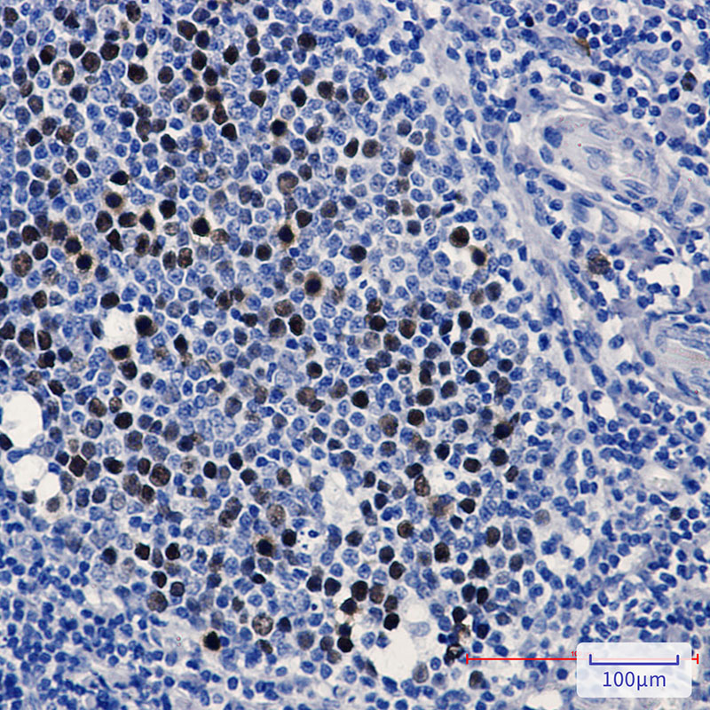 KIFC1 Rabbit mAb ABZ1868