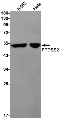 PSS2 Rabbit mAb ABZ1869