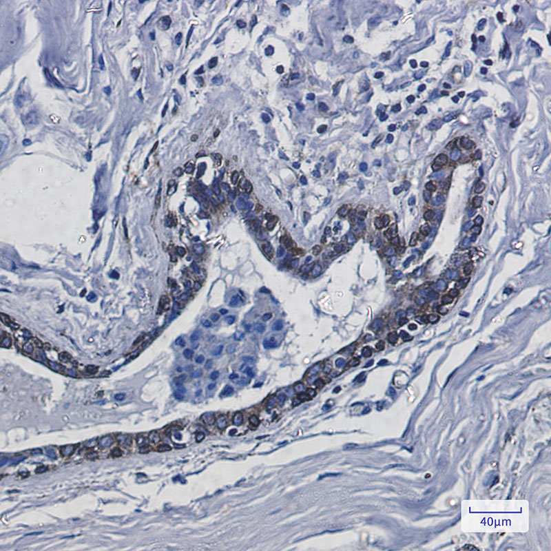 Transmembrane Protein 43 Rabbit mAb ABZ1871