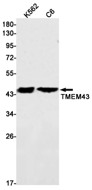 Transmembrane Protein 43 Rabbit mAb ABZ1871