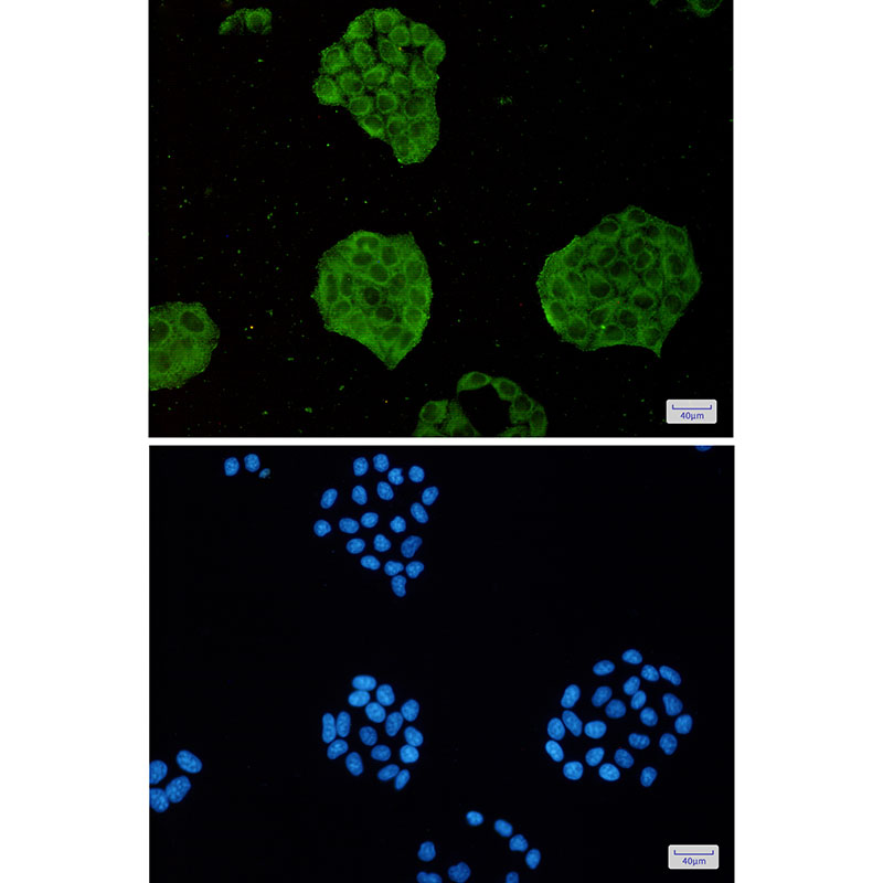 TRIM56 Rabbit mAb ABZ1872