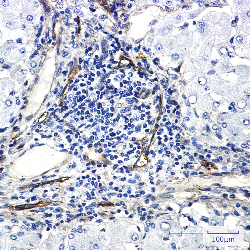 ORAI3 Rabbit mAb ABZ1873