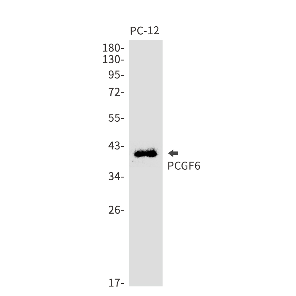 PCGF6 Rabbit mAb ABZ1874