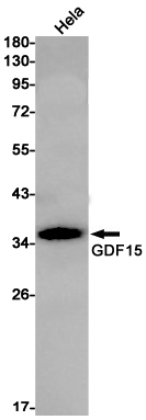 GDF15 Rabbit mAb ABZ1875