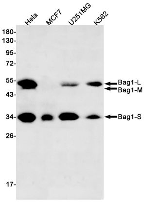 BAG1 Rabbit mAb ABZ1876
