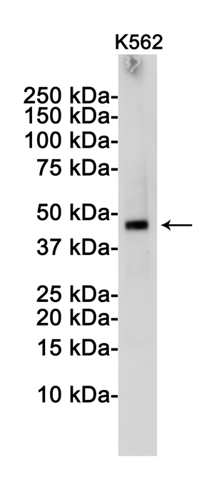 TSG101 Rabbit mAb ABZ1877
