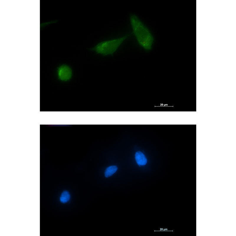 TSG101 Rabbit mAb ABZ1878