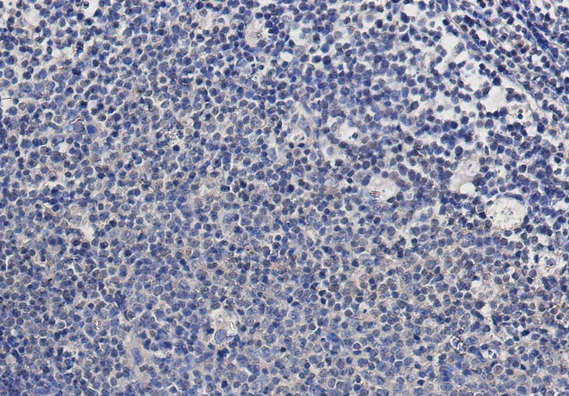 TSG101 Rabbit mAb ABZ1878
