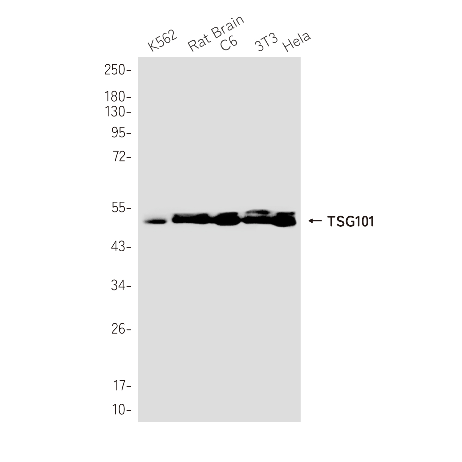 TSG101 Rabbit mAb ABZ1878
