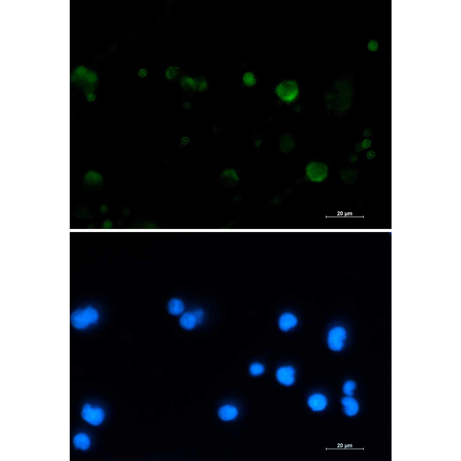Aconitase 2 Rabbit mAb ABZ1879