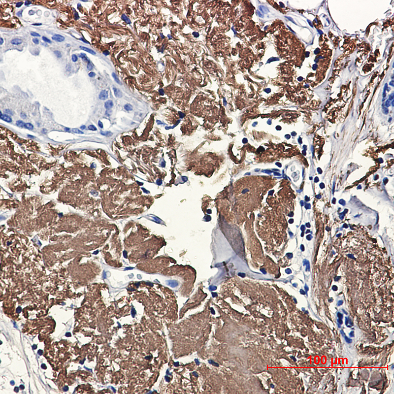 Aconitase 2 Rabbit mAb ABZ1879