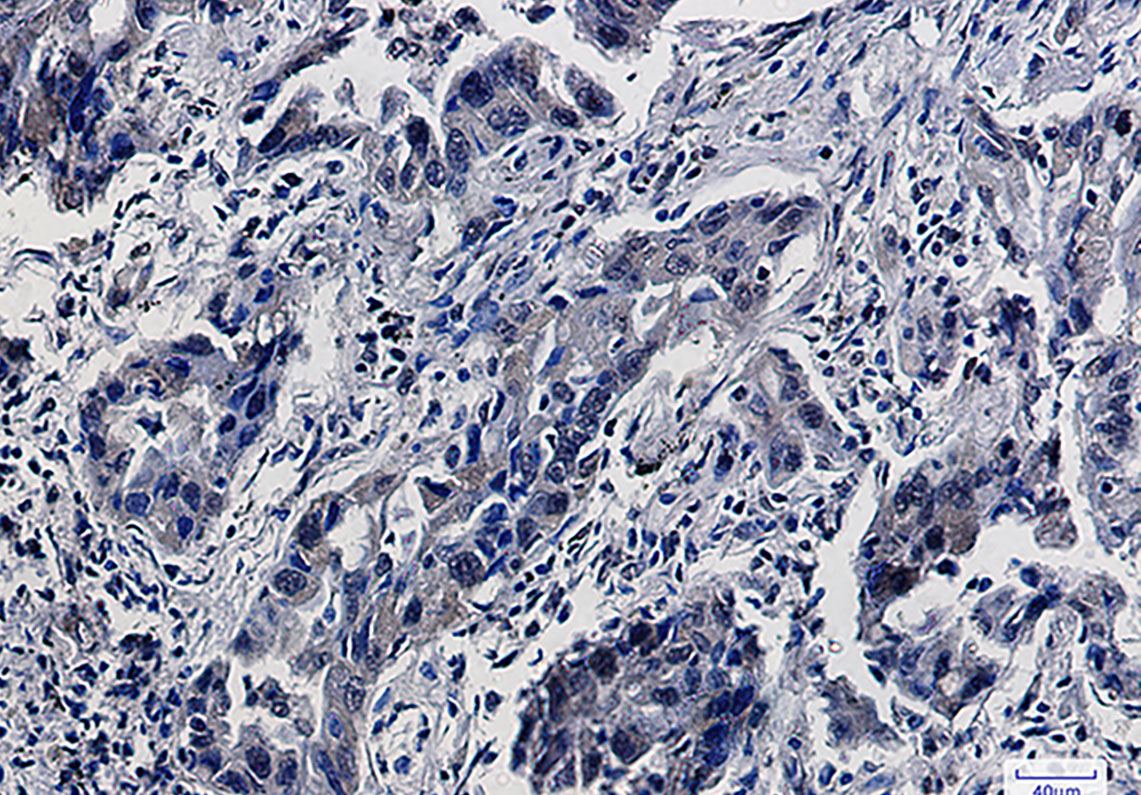 Smad5 Rabbit mAb ABZ1881