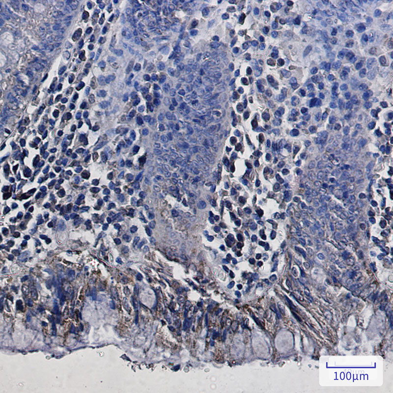 REA Rabbit mAb ABZ1884
