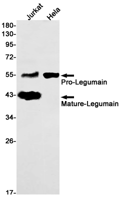 LGMN Rabbit mAb ABZ1885