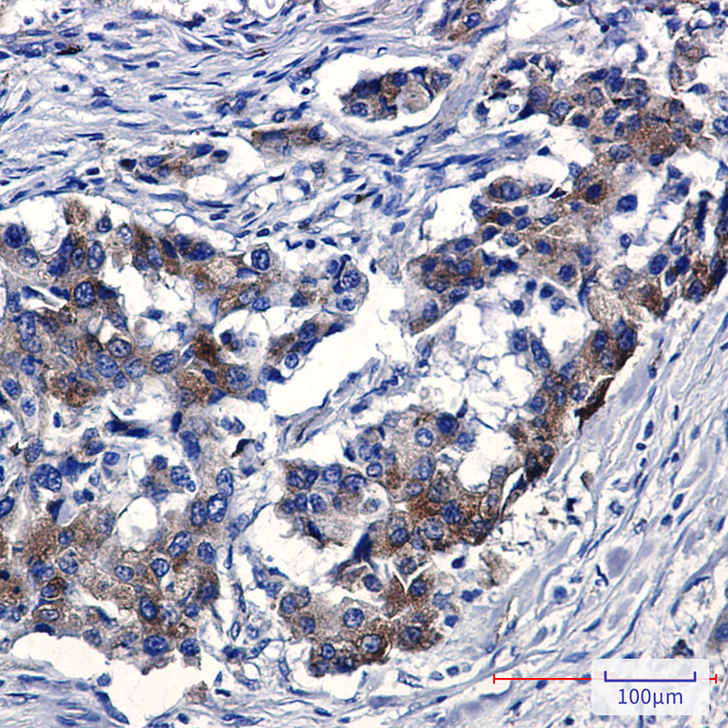 Sortilin Rabbit mAb ABZ1886