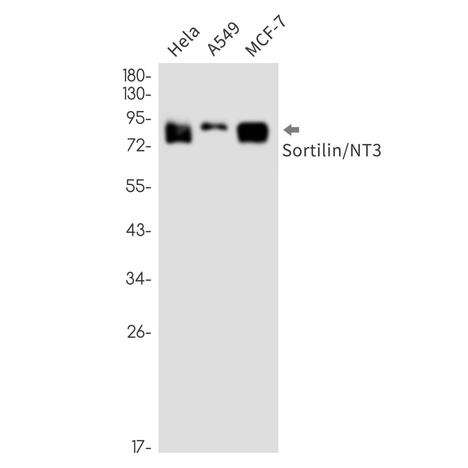 Sortilin Rabbit mAb ABZ1886