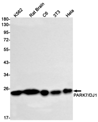 PARK7/DJ1 Rabbit mAb ABZ1887