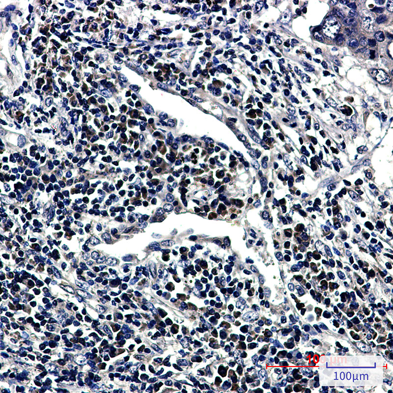 RING2 / RING1B / RNF2 Rabbit mAb ABZ1888