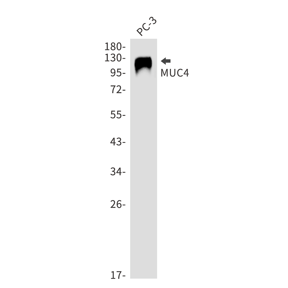MUC4 Rabbit mAb ABZ1891