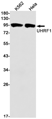 UHRF1 Rabbit mAb ABZ1893