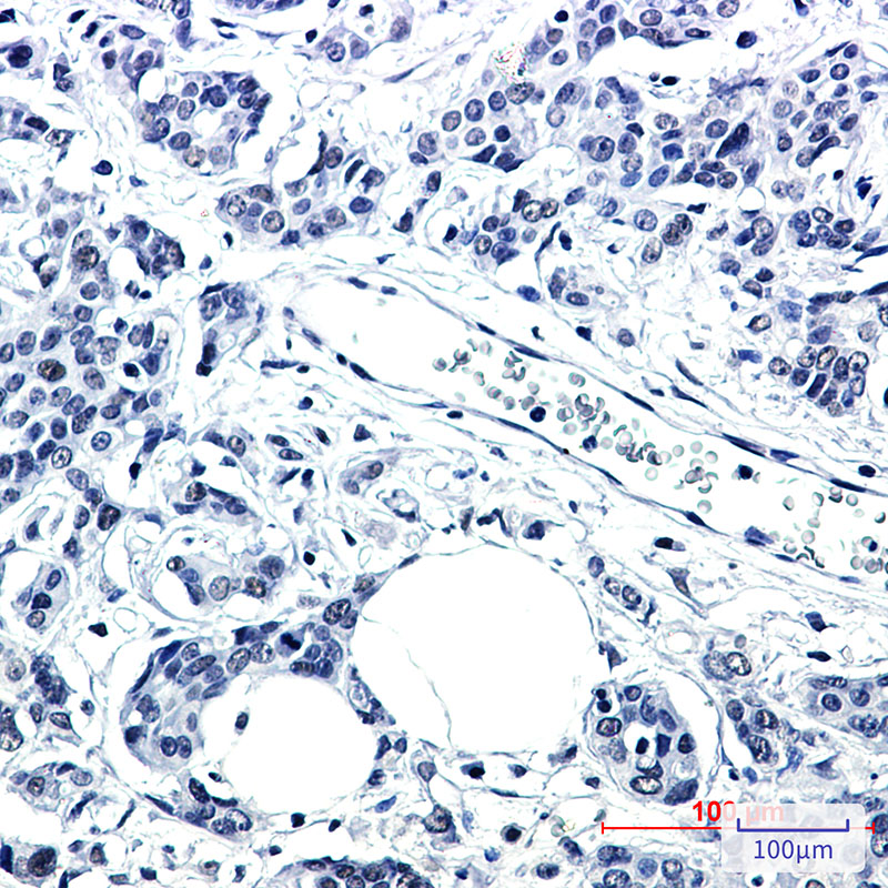 PNKP Rabbit mAb ABZ1894