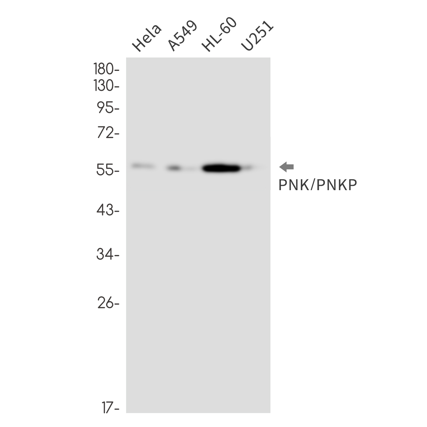 PNKP Rabbit mAb ABZ1894