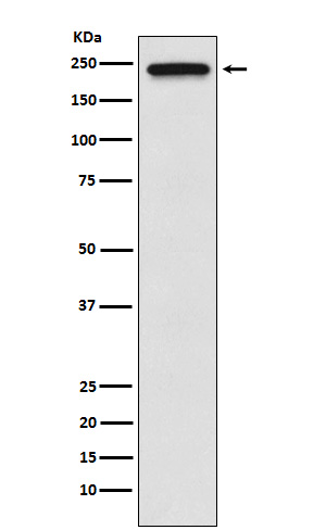 TRPM7 Rabbit mAb ABZ1900