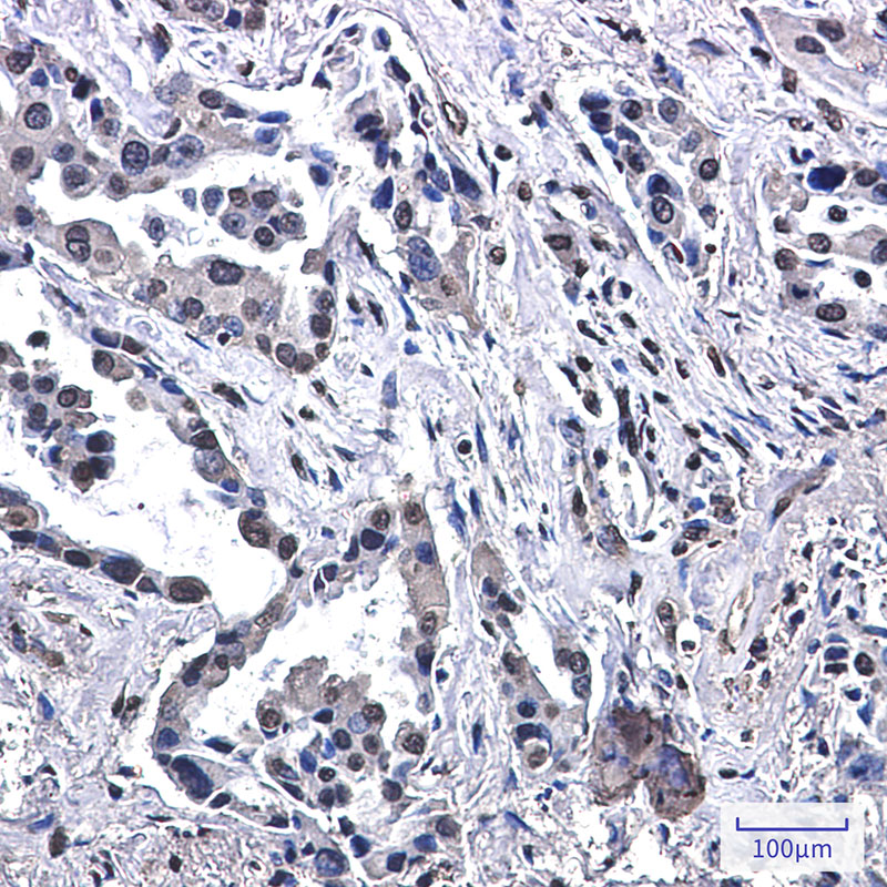 VPS35 Rabbit mAb ABZ1901