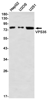 VPS35 Rabbit mAb ABZ1901