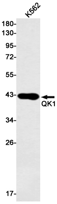 QK1 Rabbit mAb ABZ1904