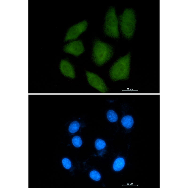 Importin 9 Rabbit mAb ABZ1906