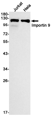 Importin 9 Rabbit mAb ABZ1906