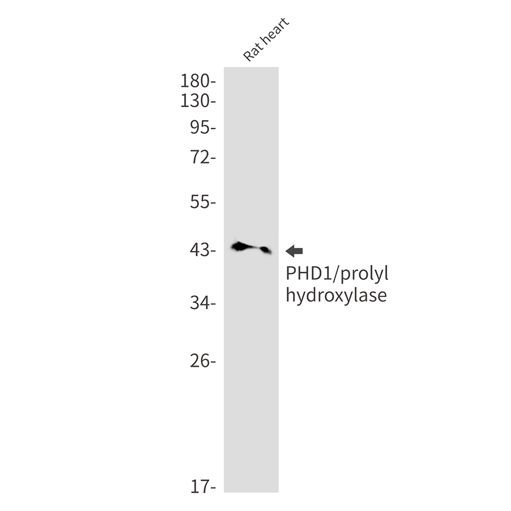 PHD1/prolyl hydroxylase Rabbit mAb ABZ1908