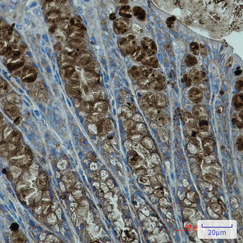 PBK Rabbit mAb ABZ1909