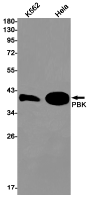 PBK Rabbit mAb ABZ1909