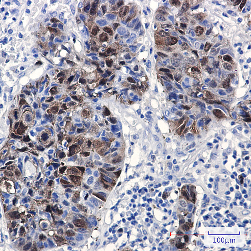 PBK Rabbit mAb ABZ1910
