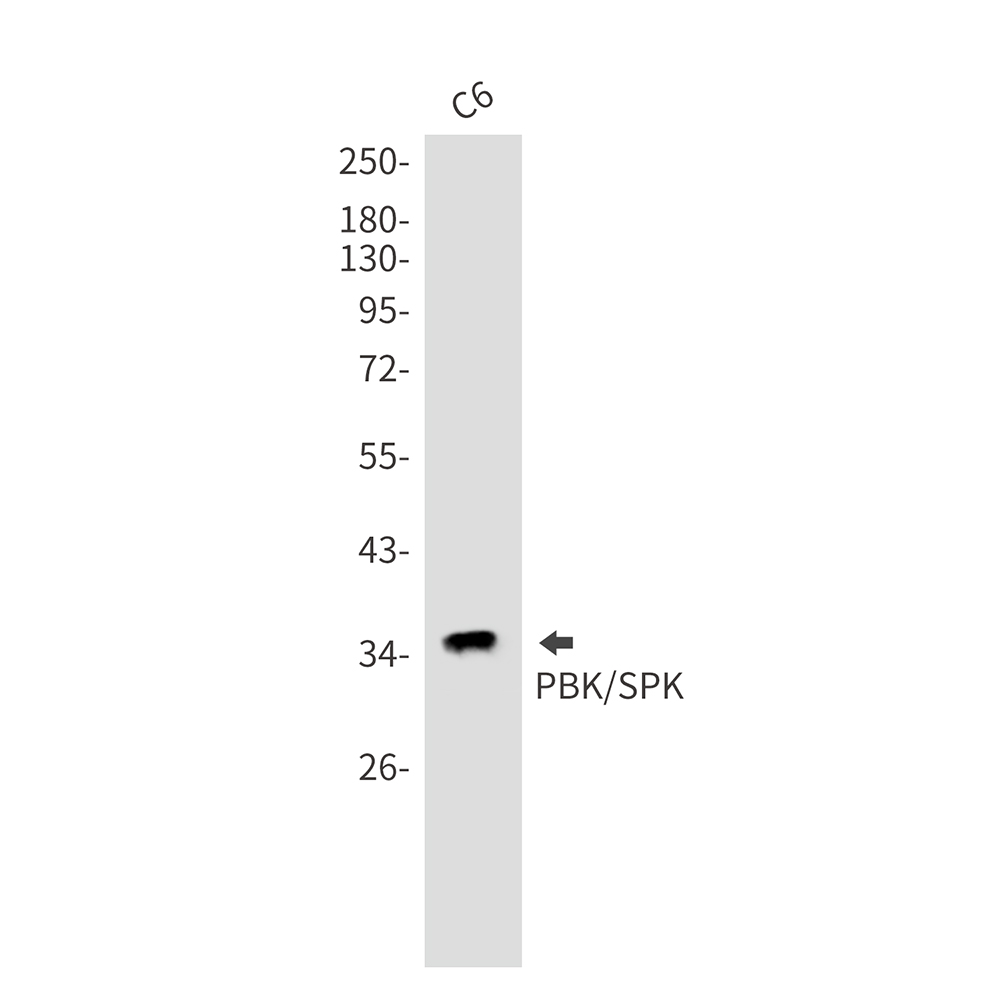 PBK Rabbit mAb ABZ1910