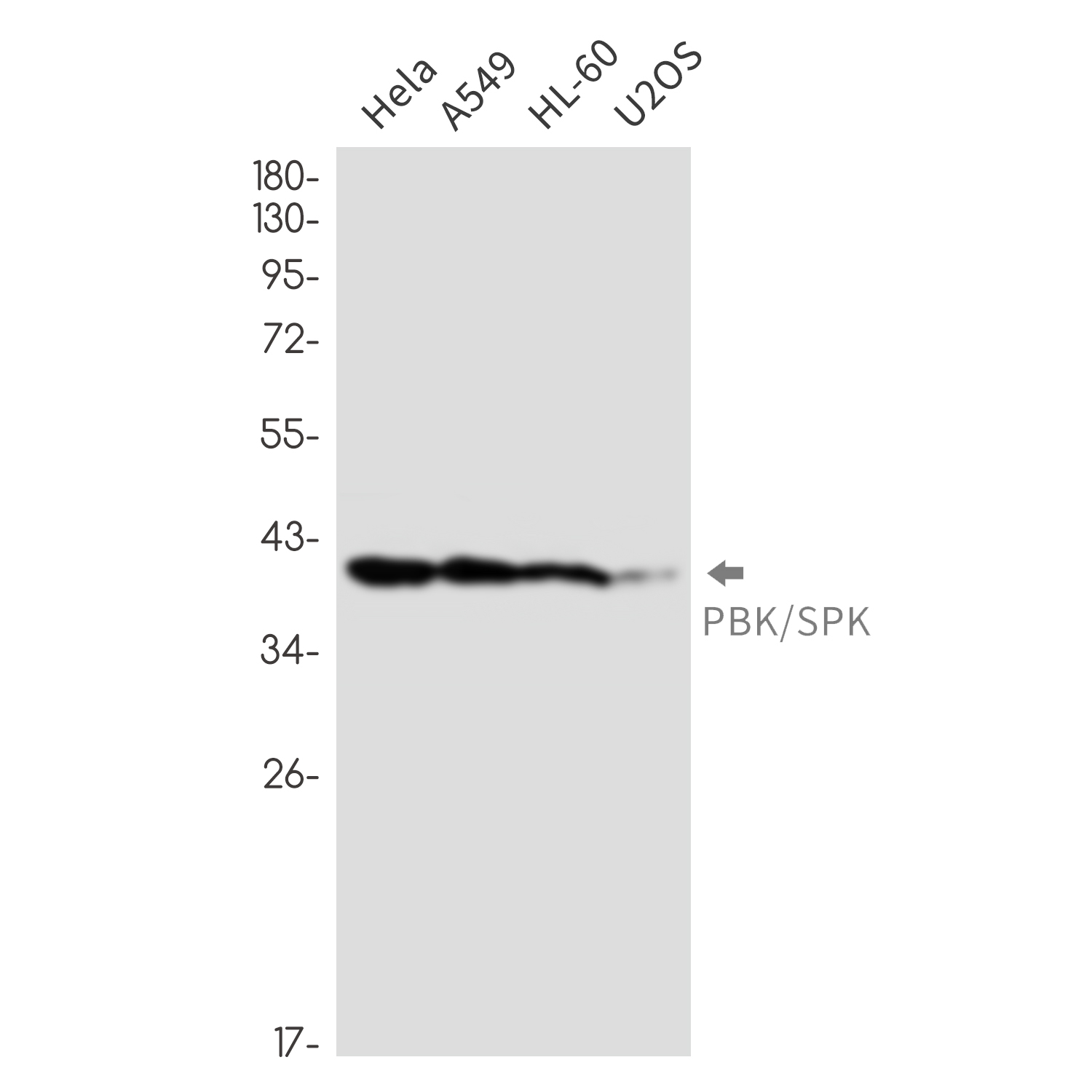 PBK Rabbit mAb ABZ1910