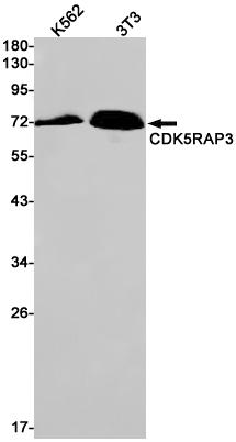 CDK5RAP3 Rabbit mAb ABZ1911