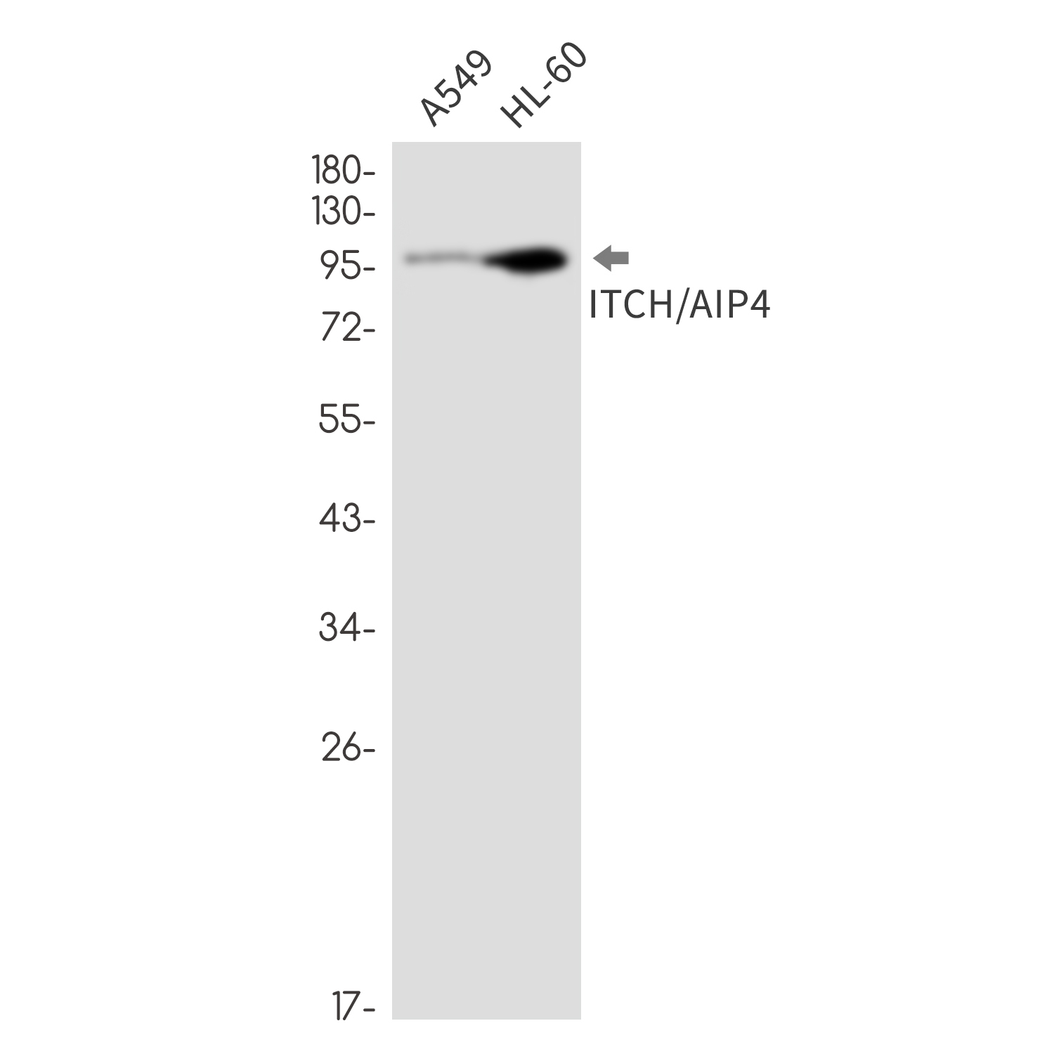 ITCH/AIP4 Rabbit mAb ABZ1913