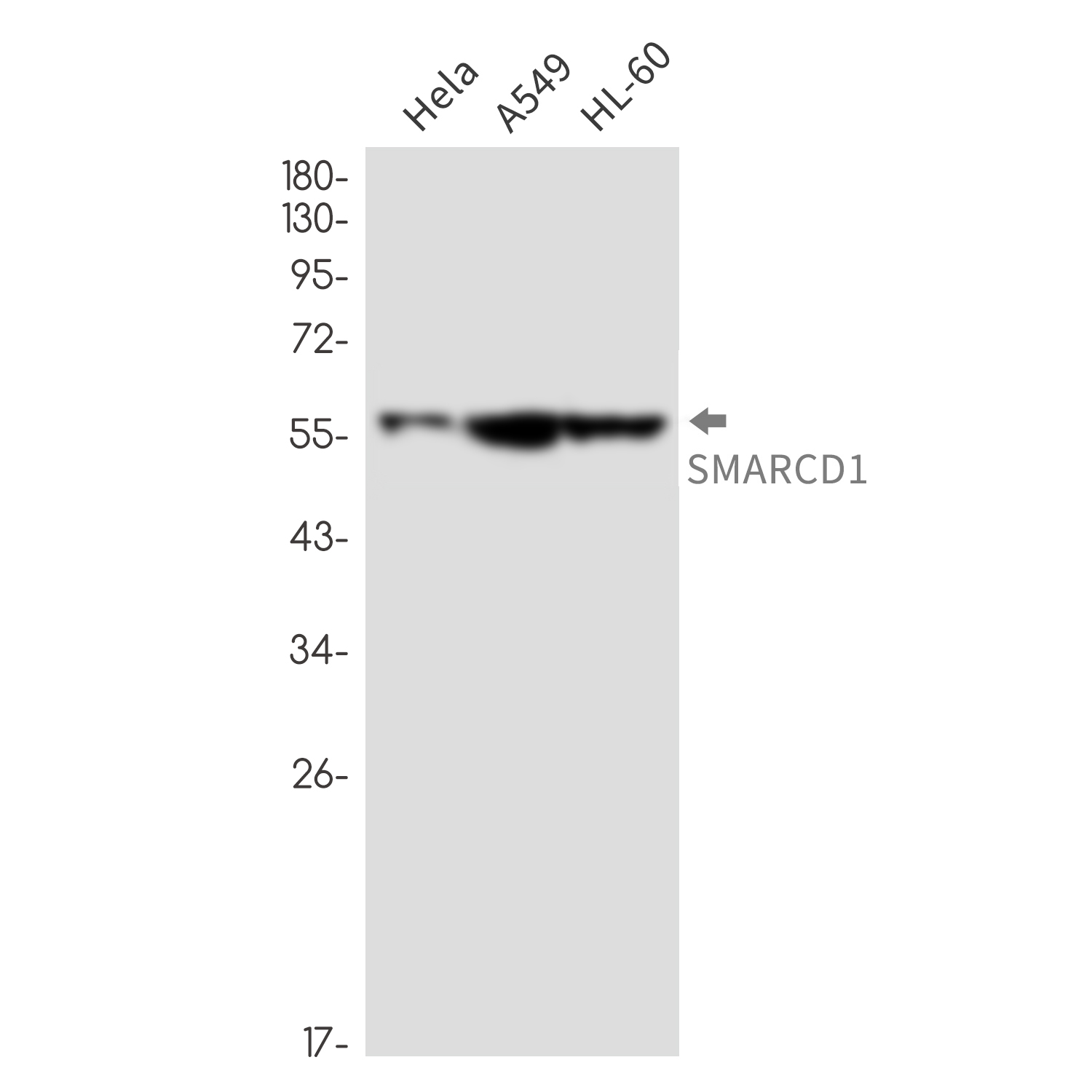 SMARCD1 Rabbit mAb ABZ1916