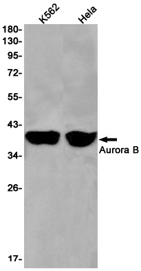 Aurora B Rabbit mAb ABZ1917
