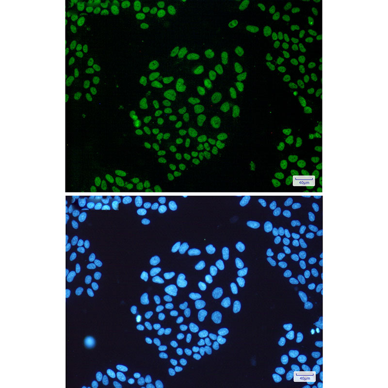 THOC1 Rabbit mAb ABZ1919