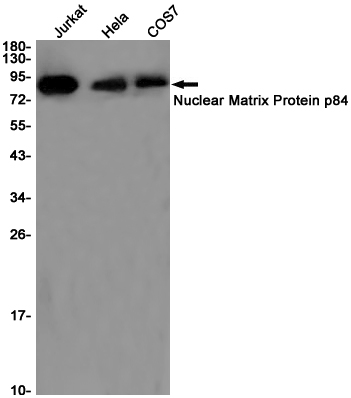 THOC1 Rabbit mAb ABZ1919
