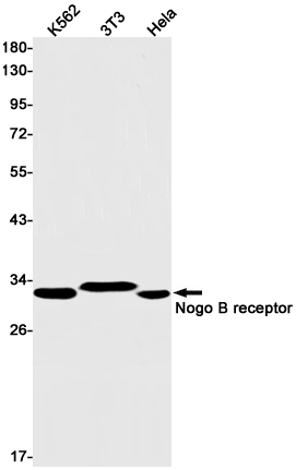 Nogo B Receptor Rabbit mAb ABZ1921