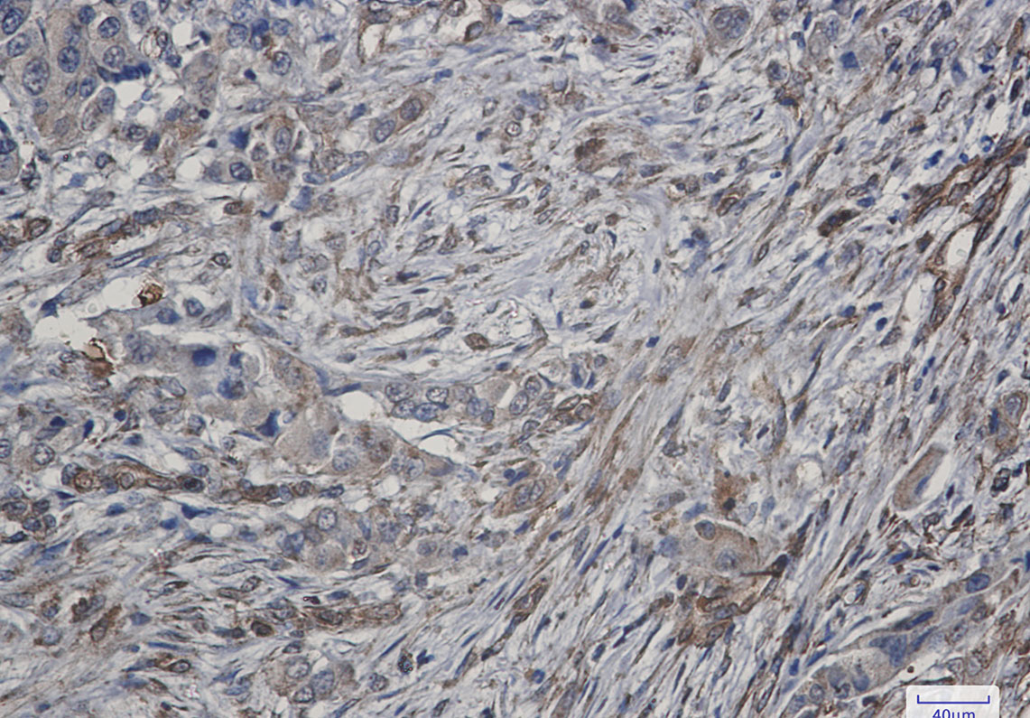 ATG4C Rabbit mAb ABZ1923