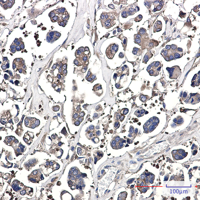 Optineurin Rabbit mAb ABZ1924
