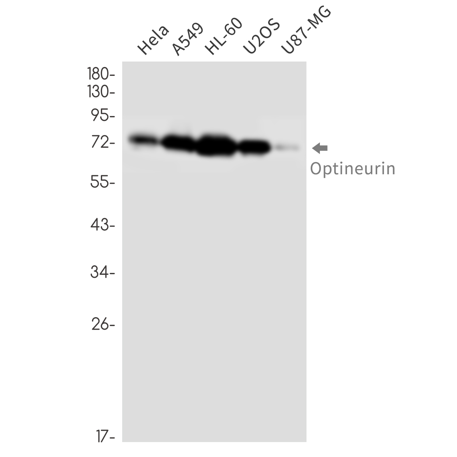 Optineurin Rabbit mAb ABZ1924
