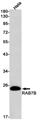 Rab7B Rabbit mAb ABZ1926
