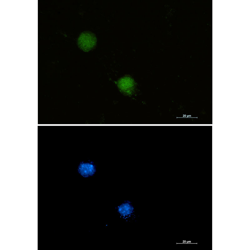 FUBP1/FBP Rabbit mAb ABZ1927